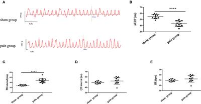 Muscarinic receptor regulation of chronic pain-induced atrial fibrillation